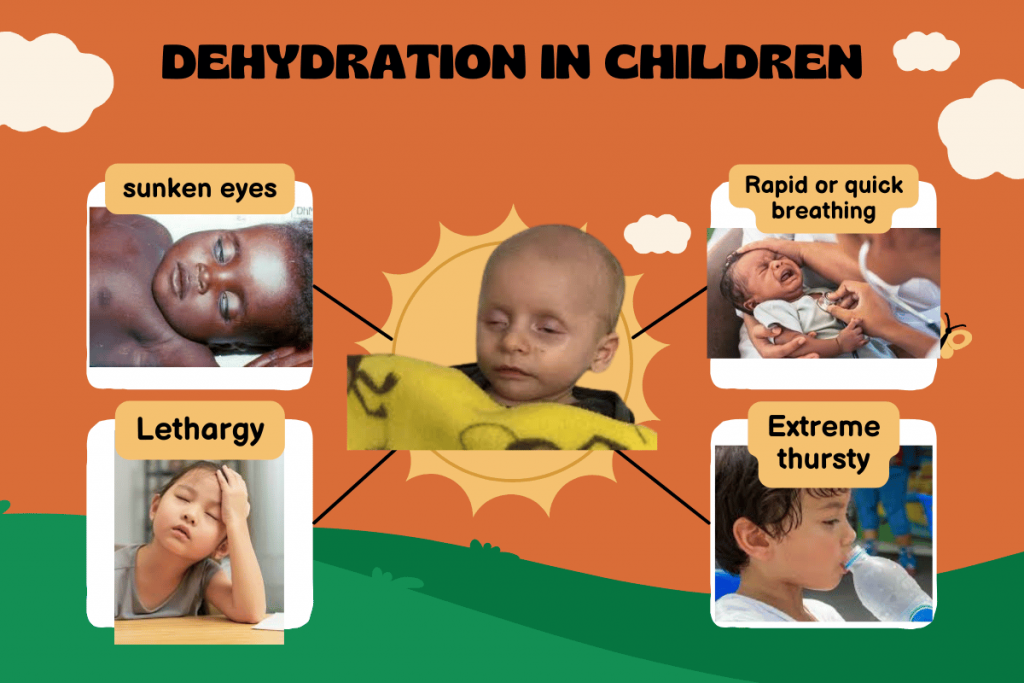 How to Identify Dehydration in Children Due to Diarrhea and Vomiting ...