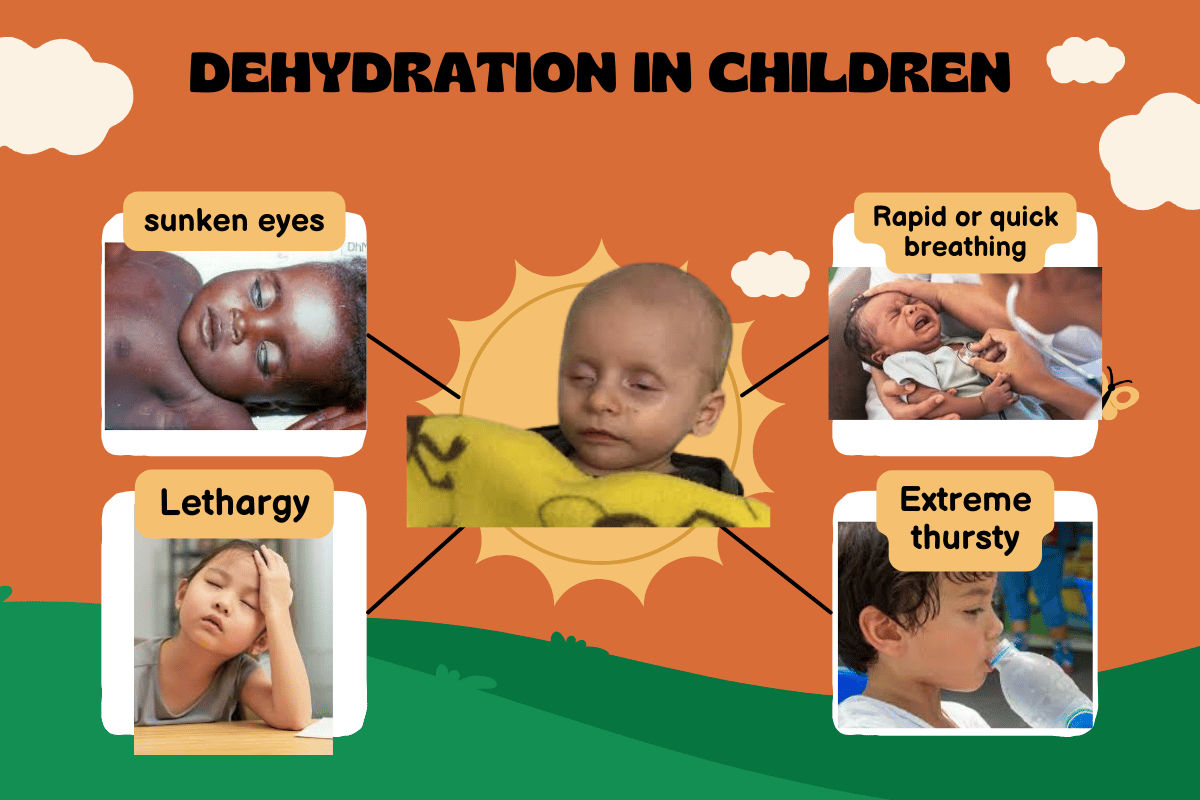 dehydration in children